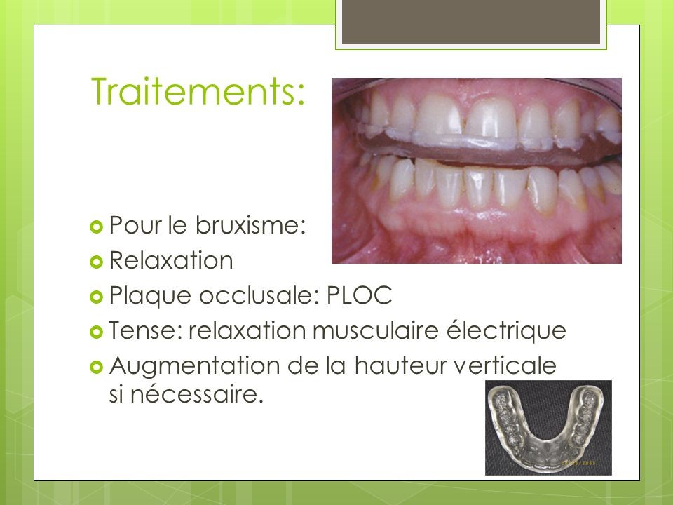 Plaque occlusale